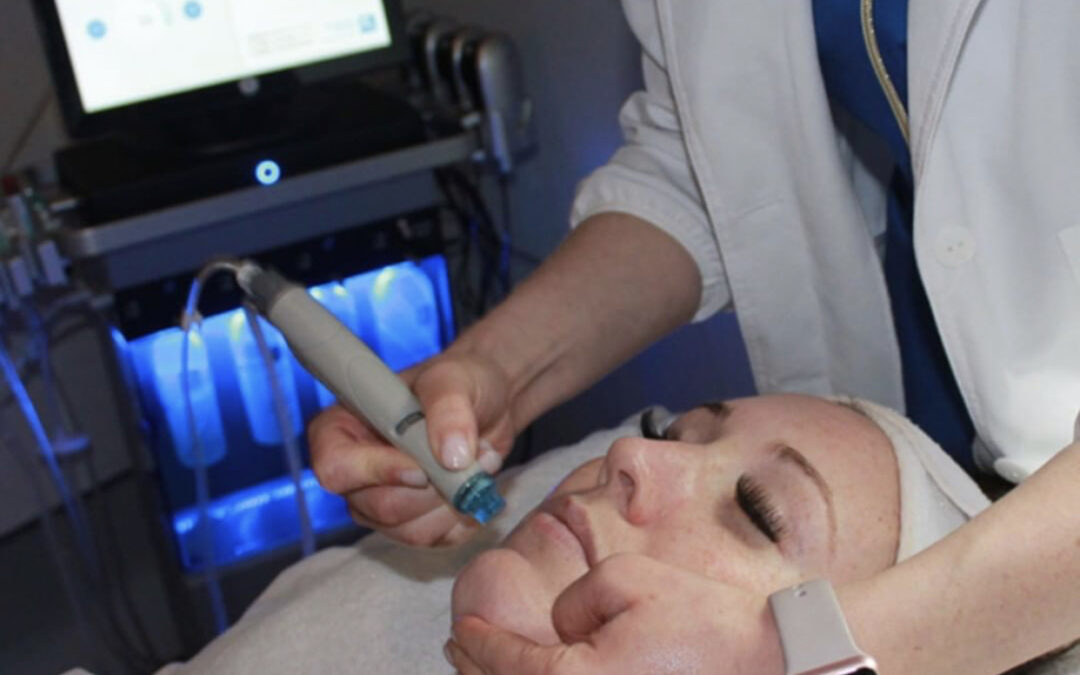 Ashley - Hydrafacial