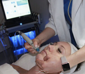 Ashley - Hydrafacial